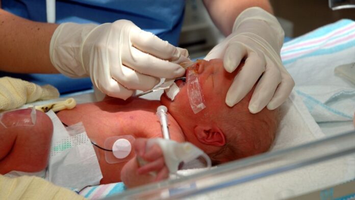 Neonato em UTI recém-nascido em UTI neonatal sendo avaliado quando a necessidade de reanimação neonatal pelo algoritmo atualizado da SBP