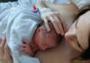 Método Canguru e neurodesenvolvimento de prematuros: benefícios além da sobrevida neonatal contato pele a pele entre o bebê prematuro recém-nascido e sua mãe, conhecido como método canguru