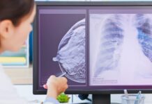 Inluriyo® (inlunestranto) no câncer de mama ER+: indicações, eficácia e segurança Médica avaliando exames de câncer de mama para indicação de tratamento com inlunestranto (Inluriyo®).