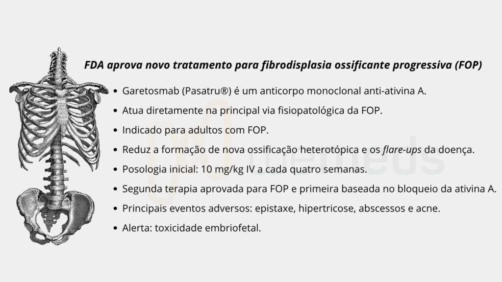 FDA aprova novo tratamento para fibrodisplasia ossificante progressiva (FOP)