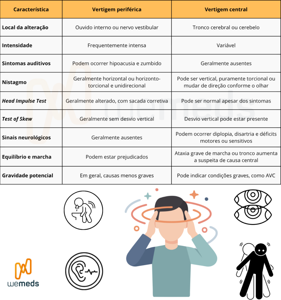tabela com diferença entre vertigem central e periférica