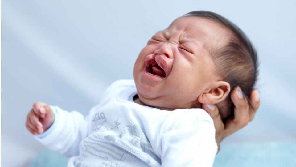 bebê com fissura labiopalatina, que pode ser identificada precocemente no Teste do Céuzinho 