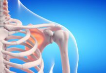 FDA aprova novo tratamento para fibrodisplasia ossificante progressiva (FOP) ilustração de esqueleto humano em crescimento, representando a fibrodisplasia ossificante progressiva