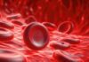 Nipocalimabe é aprovado para anemia hemolítica autoimune por anticorpos quentes hemácias, células afetadas na anemia hemolítica autoimune por anticorpos quentes