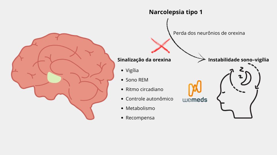 Oveporexton atua no sistema de orexina e perda dos neurônios orexinérgicos na narcolepsia tipo 1.