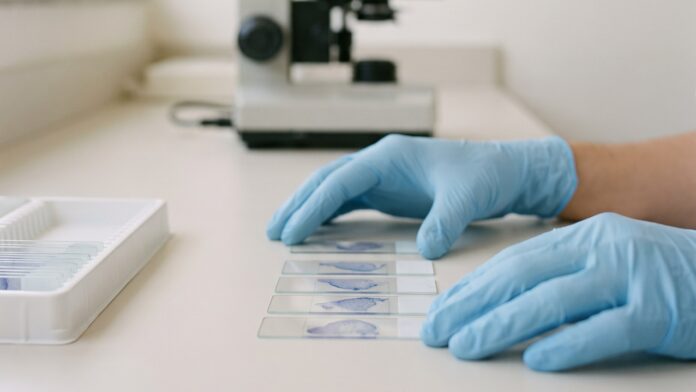 profissional de laboratório analisando amostras coletadas de paciente com câncer de mama quádruplo-negativo profissional de laboratório analisando amostras coletadas de paciente com câncer de mama quádruplo-negativo